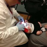 Infant Frenum Release Post-Operative image 1